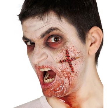 Cicatrice Points Suturée en Croix