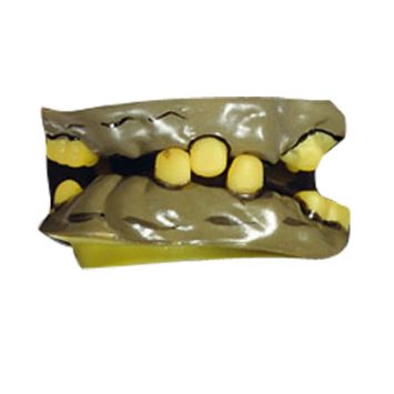 Dents de Sorcière Pourries