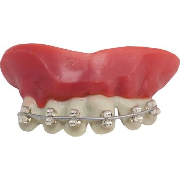 Dentier humour avec faux appareil dentaire réaliste | jourdefete.com Dentier humour avec faux appareil dentaire réaliste | jourdefete.com
